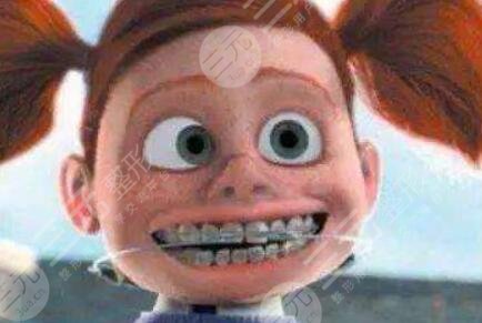 南通口腔醫(yī)院整牙案例