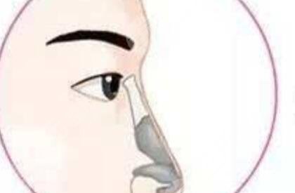 薛克墘做鼻子咨詢過程