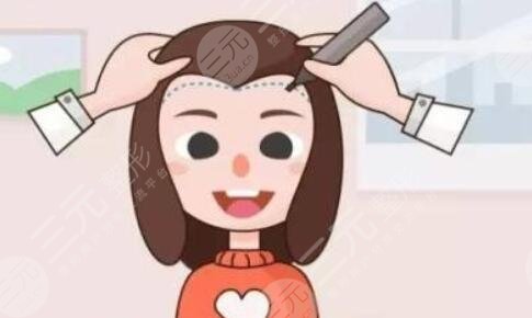 貴陽口碑植發(fā)醫(yī)院案例