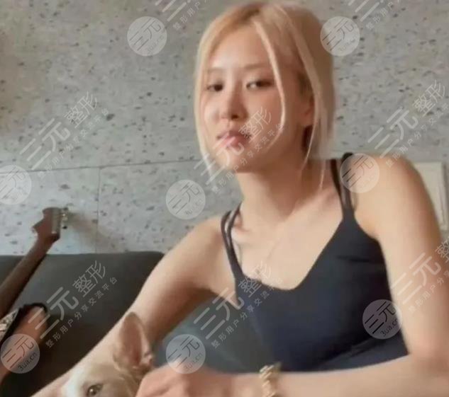 樸彩英整容變美經(jīng)過(guò)歷程：