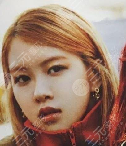 樸彩英整容變美經(jīng)過(guò)歷程：