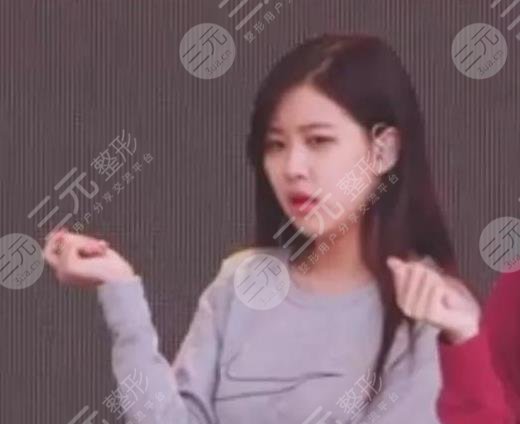 BLACKPINK樸彩英(Rosé)整容了?