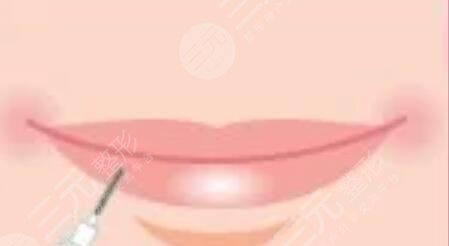 漂唇恢復(fù)七天過程圖，附個(gè)人漂唇經(jīng)歷過程圖片