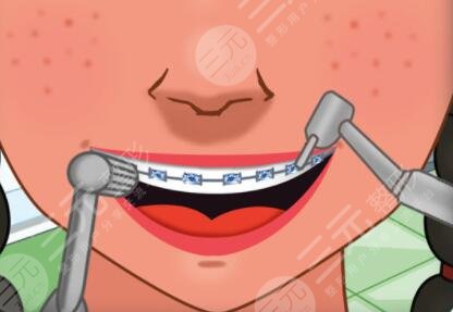 南通口腔醫(yī)院是公立醫(yī)院嗎