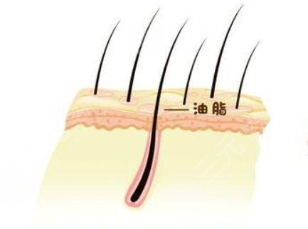 南京新生植發(fā)靠譜嗎？附發(fā)際線植發(fā)的真實經(jīng)歷