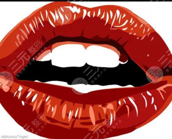 厚唇改薄七天恢復圖