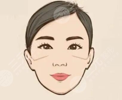 武漢新至美整形價(jià)格表|隆下頜真實(shí)案例立現(xiàn)鵝蛋臉