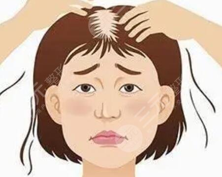 蘭州雍禾植發(fā)醫(yī)院發(fā)際線改良案例