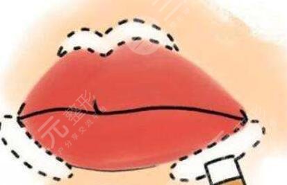 m唇手術(shù)對比照