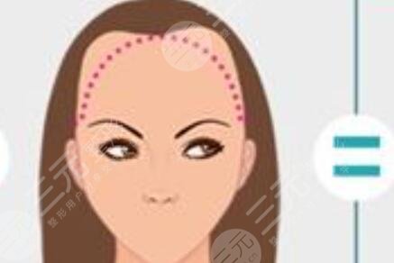 哈爾濱藝星植發(fā)怎么樣