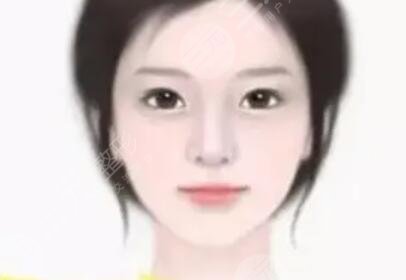 年前做的大腿吸脂塑型，現(xiàn)在有點(diǎn)后悔做腰部的吸脂