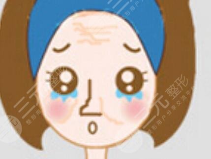 玻尿酸打山根果圖