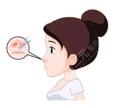 江映蓉到底做沒做整形手術(shù)，照片對比，鼻子越來越具有歐美范兒！