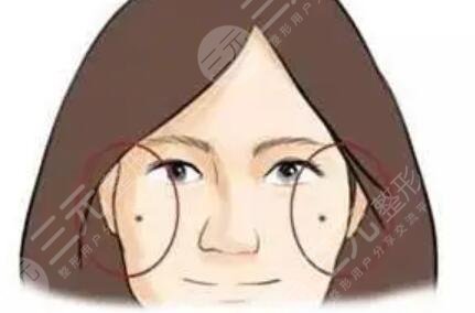 西京醫(yī)院整形美容科激光去痣案例，附全新價(jià)格表~