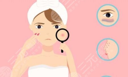 切開修復(fù)重瞼