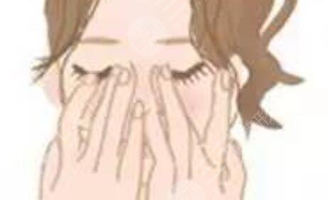 隆鼻整形手術(shù)之后