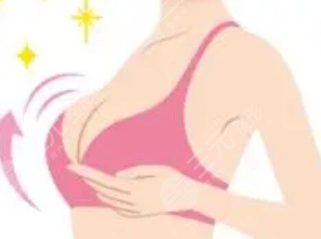 隆胸手術前后照片