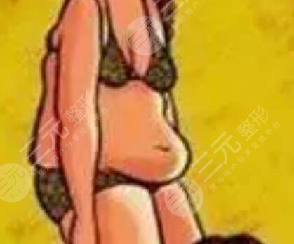 長沙素妍整形價(jià)格表|吸脂瘦腿案例分享立現(xiàn)筷子腿