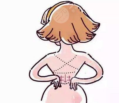 手臂抽脂真實(shí)經(jīng)歷：術(shù)前準(zhǔn)備