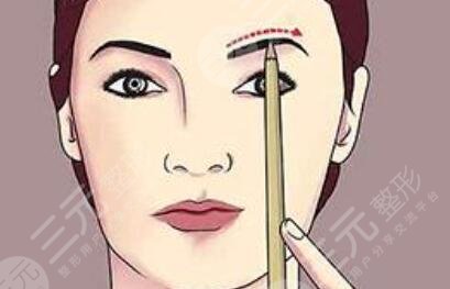 激光洗眉十天后照片，恢復(fù)全過(guò)程記錄