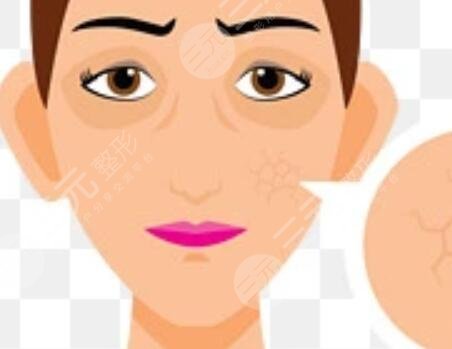 光子嫩膚去雀斑后悔了