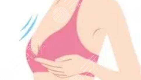 假體隆胸術(shù)前注意事項