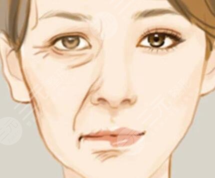 面部拉皮整容手術案例：50歲+阿姨，變身30歲姐姐的心路歷程！