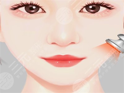 去頰脂墊瘦臉明X嗎？來看真人去頰脂墊瘦臉的手術(shù)過程及恢復(fù)果