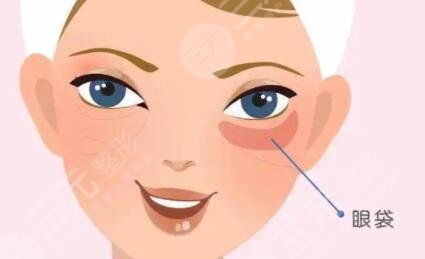 打完淚溝恢復(fù)過程圖片:真人展示填充淚溝的區(qū)別~