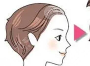 無(wú)錫新生植發(fā)醫(yī)院醫(yī)生介紹