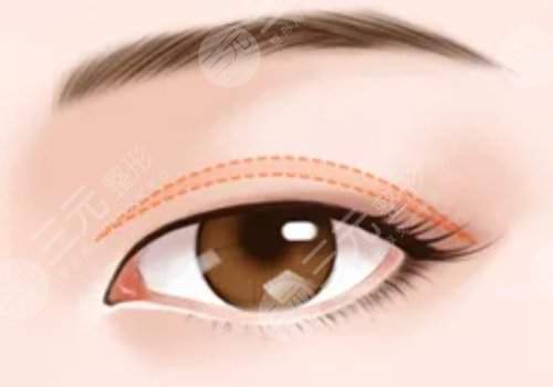 激光洗眉一到七天圖片