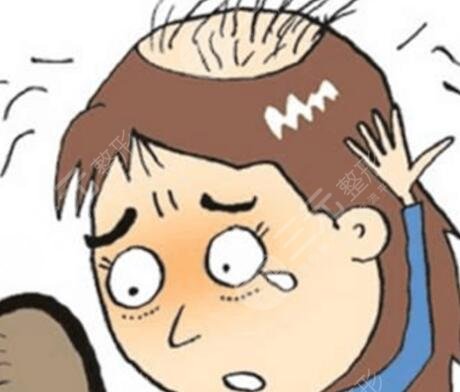 杭州植發(fā)醫(yī)院排行榜