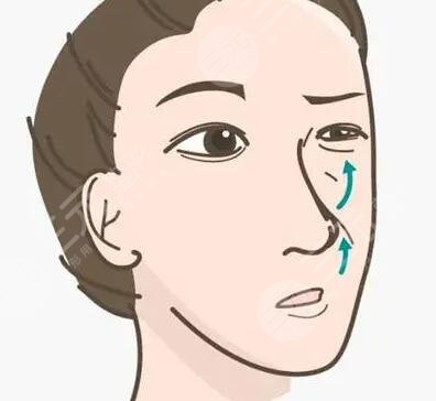 北京沁伊爾醫(yī)療美容診所隆鼻整形案例術(shù)前