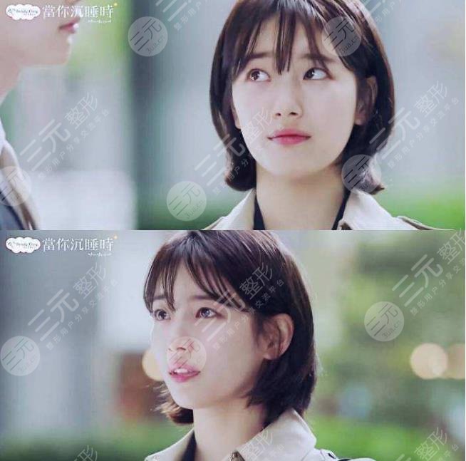 裴秀智微整泡到李敏鎬！從土氣女孩到韓劇女主？她動了哪些地方？