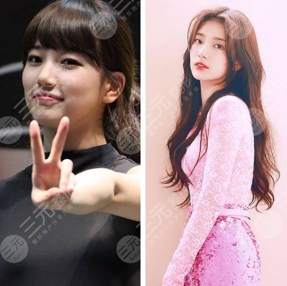 【裴秀智變美過程分享】