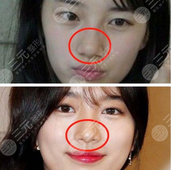 【裴秀智整容了嗎】