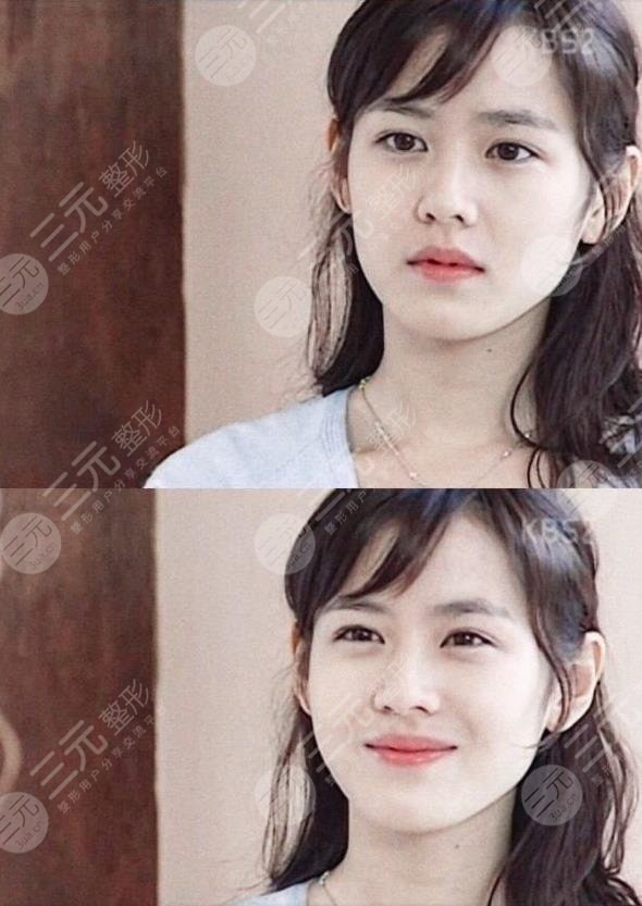 韓國神顏演員孫藝珍顏值如何?