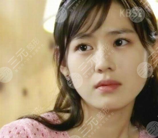 韓國神顏演員孫藝珍顏值如何?