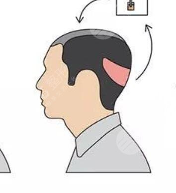 無錫雍禾醫(yī)院怎么樣