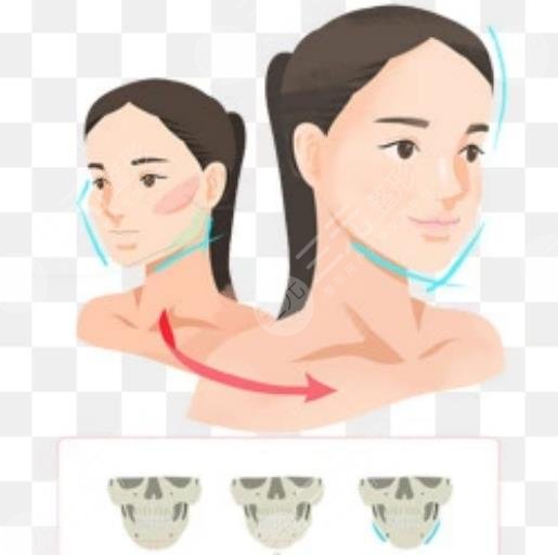 上海吉玟錫磨骨前