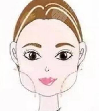 李志海醫(yī)生下頜角切除手術(shù)科普