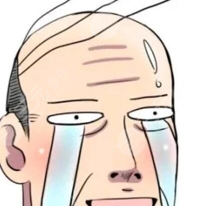 脫發(fā)禿頂緩解