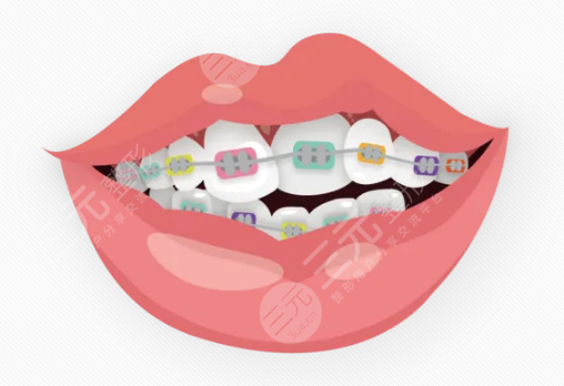 牙齒矯正