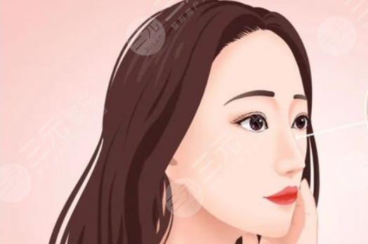 昆山達拉斯劉波隆鼻案例 術(shù)前