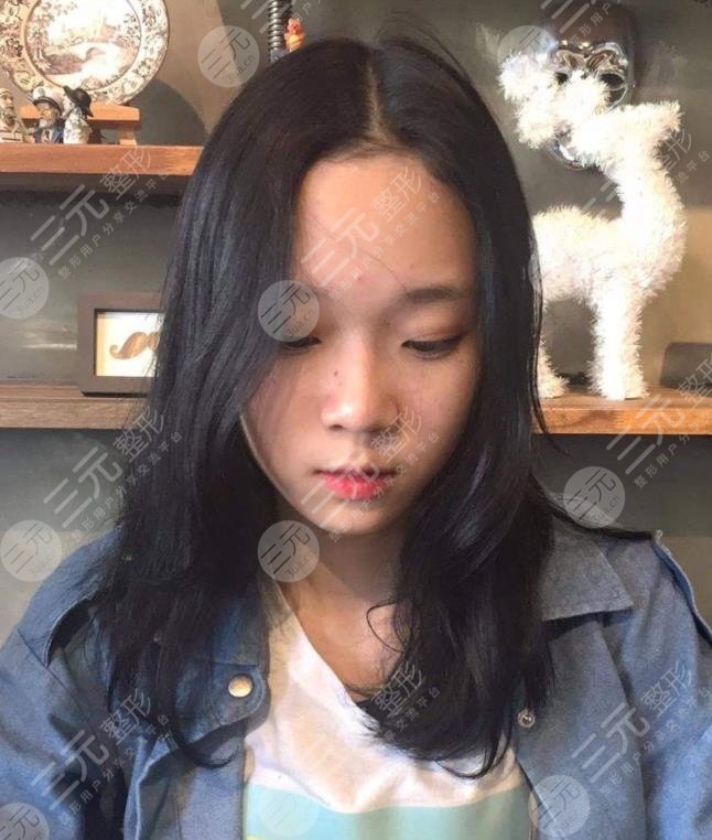 金玟庭winter陷整容風(fēng)波，她動(dòng)了哪里?