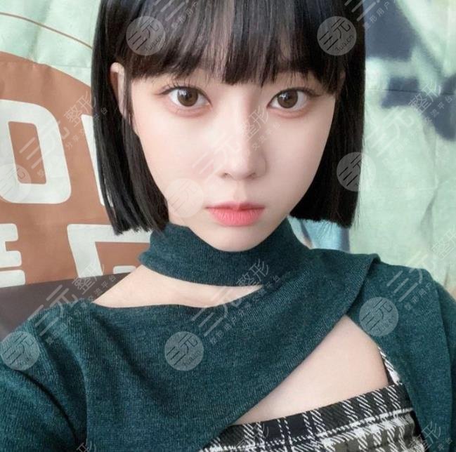 金玟庭winter陷整容風(fēng)波，她動(dòng)了哪里?