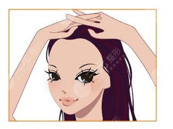 北京中德植發(fā)醫(yī)院發(fā)際線改良植發(fā)經(jīng)歷分享