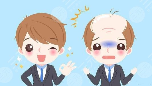 溫州大麥微針植發(fā)醫(yī)院脫發(fā)種植經(jīng)歷分享