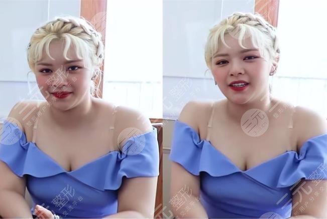 TWICE成員俞定延“發(fā)胖照”引爭(zhēng)議?