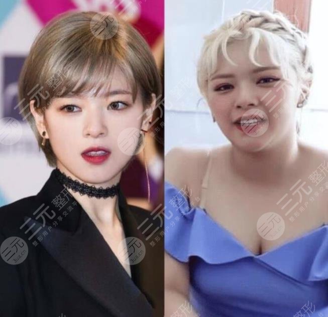 TWICE成員俞定延“發(fā)胖照”爆出！被攻擊不做身材管理顏值下降！